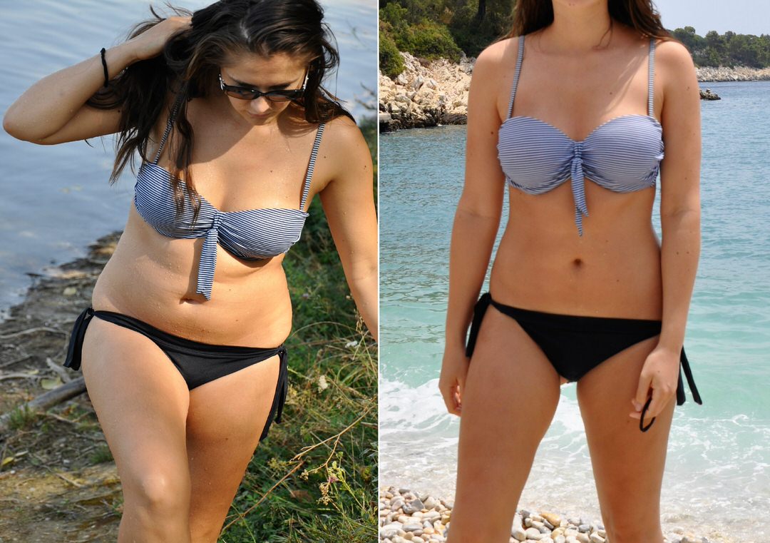 Real,Before,And,After,Weight,Loss,Photo,Of,Woman's,Body
